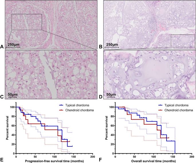 SAFETTI Girona Bib Nero Woman SM