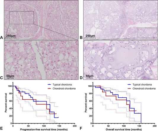 SAFETTI Girona Bib Nero Woman SM